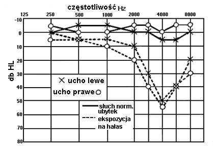 Narząd słuchu - anatomia i właściwości Lokalizacja źródeł dźwięku Zdolność słuchu do lokalizacji źródła dźwięku zależy od różnicy intensywności, częstotliwości (widma) i czasu dotarcia (faz) sygnałów