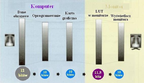 Opisywanie i prezentacja 9 Mammografia : warunki pomieszczenia opisowego Rejestracja, prezentacja, przekaz radiologicznego mgr inż.