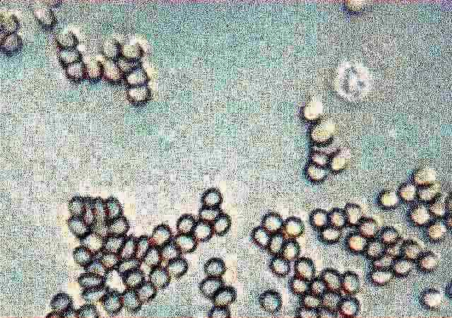 Bakterie Mikroby w kropli wody Cyrkulacjęcząsteczek krwi w naczyniach włoskowatych Czerwone i białe ciałka krwi Plemniki http://www.
