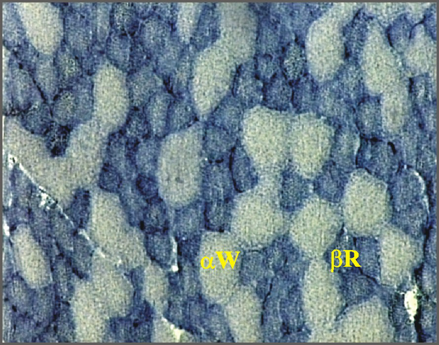 Fot. 5. Przekrój poprzeczny mięśnia pectoralis superficialis u kaczora Star 53 H.Y. (powiększenie 12,5 10) Phot. 5. Cross-section of pectoralis superficialis muscle in Star 53 H.Y. drake (magnification 12,5 10) 74 Fot.