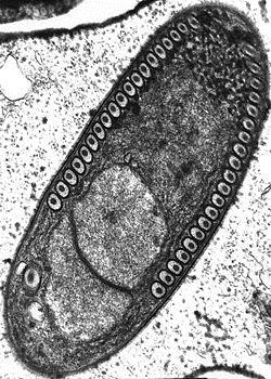 ORGANIZMY bez mitochondriów pasożytnicze eugleny Trichomonas Giardia Diplomonadida