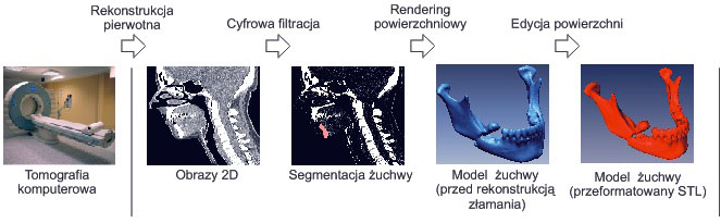 Rysunek 2 Etap akwizycji danych oraz projektowania RE [7] Na podstawie przygotowanych danych dobrano wartość 200 HU jako wartość dolnego progu segmentacji.