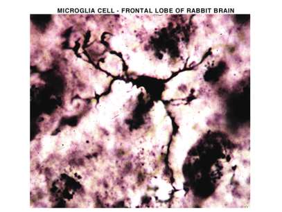 Komórki mikrogleju Komórki mikrogleju pochodzą z monocytów krwi.