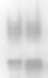 ramionach 3 pary chromosomów z diploidalnego genomu D w rejonie obejmującym od 0,23 (3DL-01) do 0,81 (3DL-03) chromatyny (rys. 13). 1 2 Pasmo AAT-3 Pasmo AAT-2 Rys. 14.