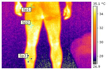 Oznaczenie punktu na zdjęciu Tors-przód Plecy-tył Nogi-przód Nogi-tył Sp1 31,4 34,3 33,1 32,4 Sp2 32,7 34,7 32,9 32,9 Sp3 32,9 32,9 33,7 33,7 Sp4 31,6 33,2 - - Parametry pomiaru ºC Emisyjność
