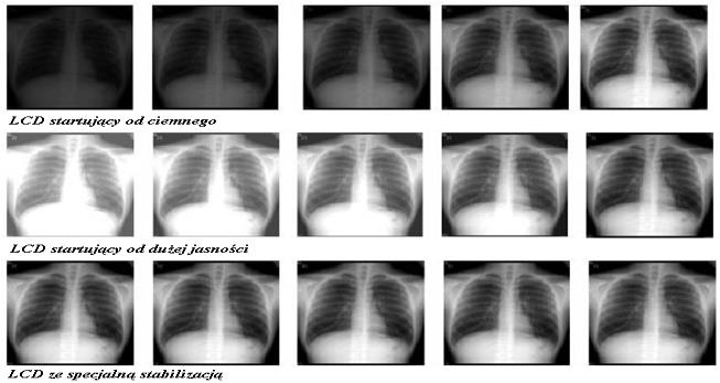 Metody otrzymywania i rejestracji obrazu radiologicznego mgr inż.