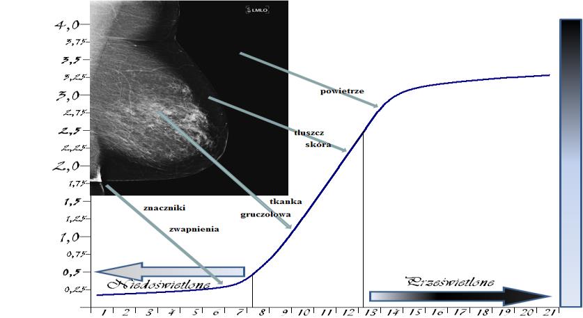 Radiografia - rejestracja cyfrowa płyty pamięciowe (CR) Metody otrzymywania i rejestracji obrazu