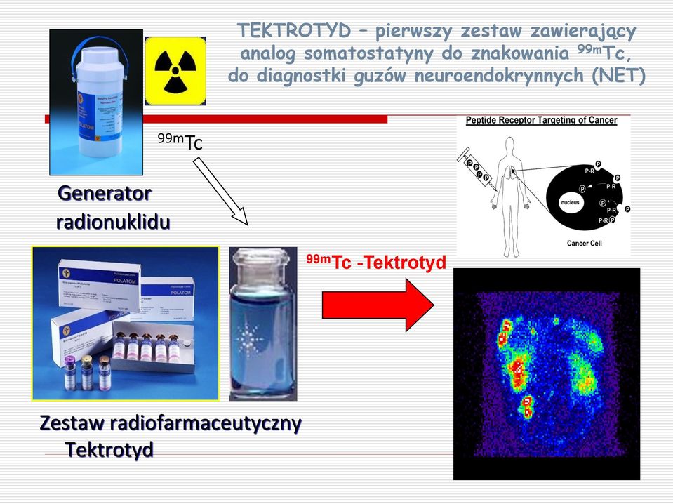 guzów neuroendokrynnych (NET) 99m Tc Generator