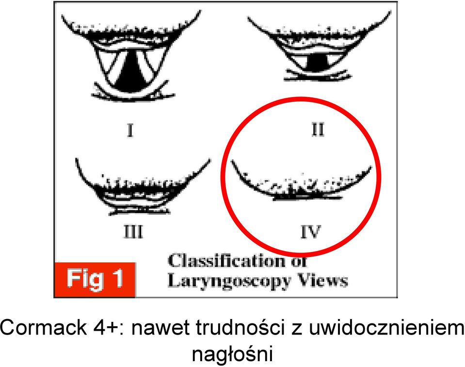 trudności z