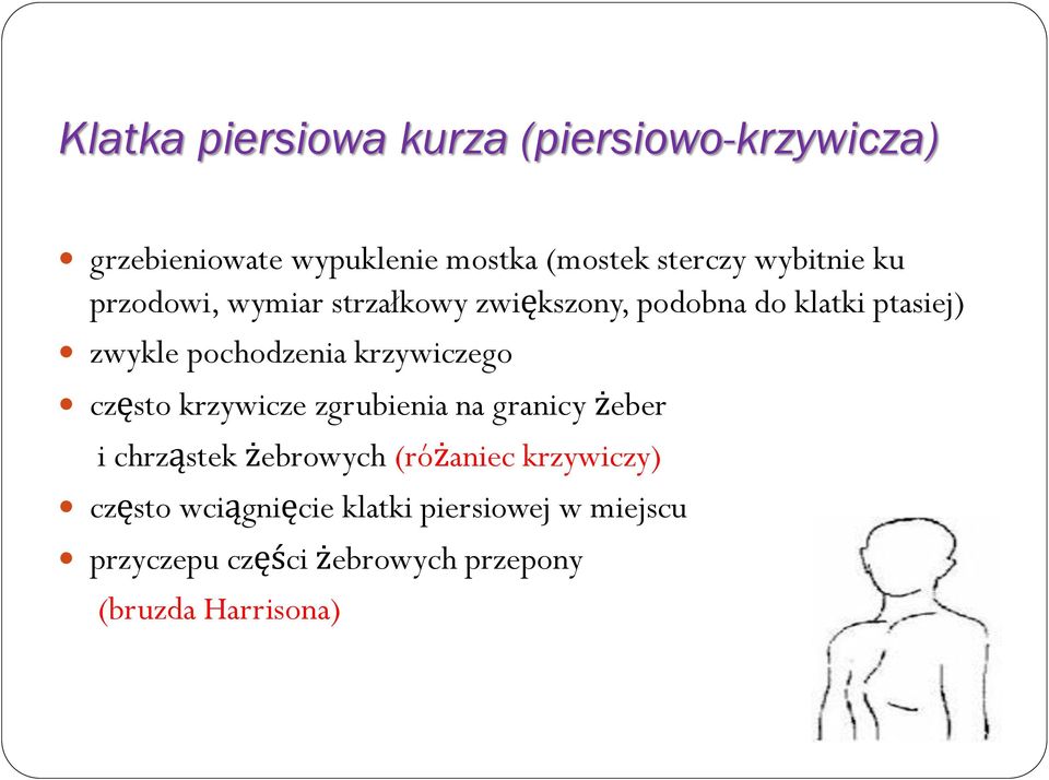 krzywiczego często krzywicze zgrubienia na granicy żeber i chrząstek żebrowych (różaniec