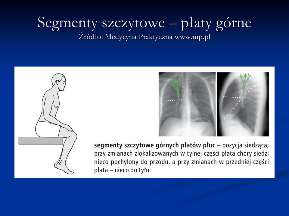 górne Źródło: