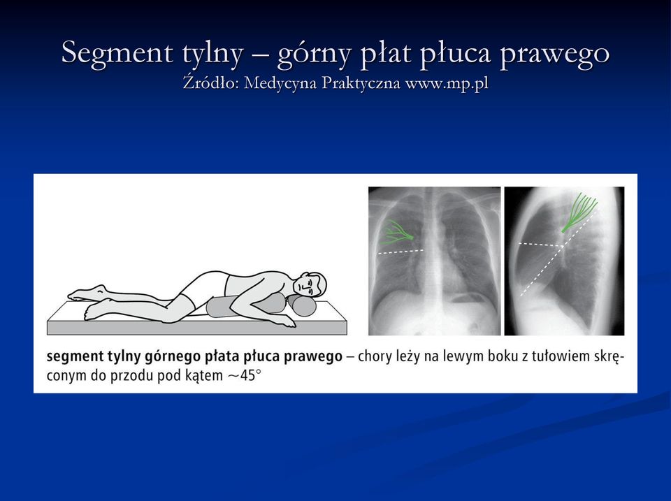 prawego Źródło: