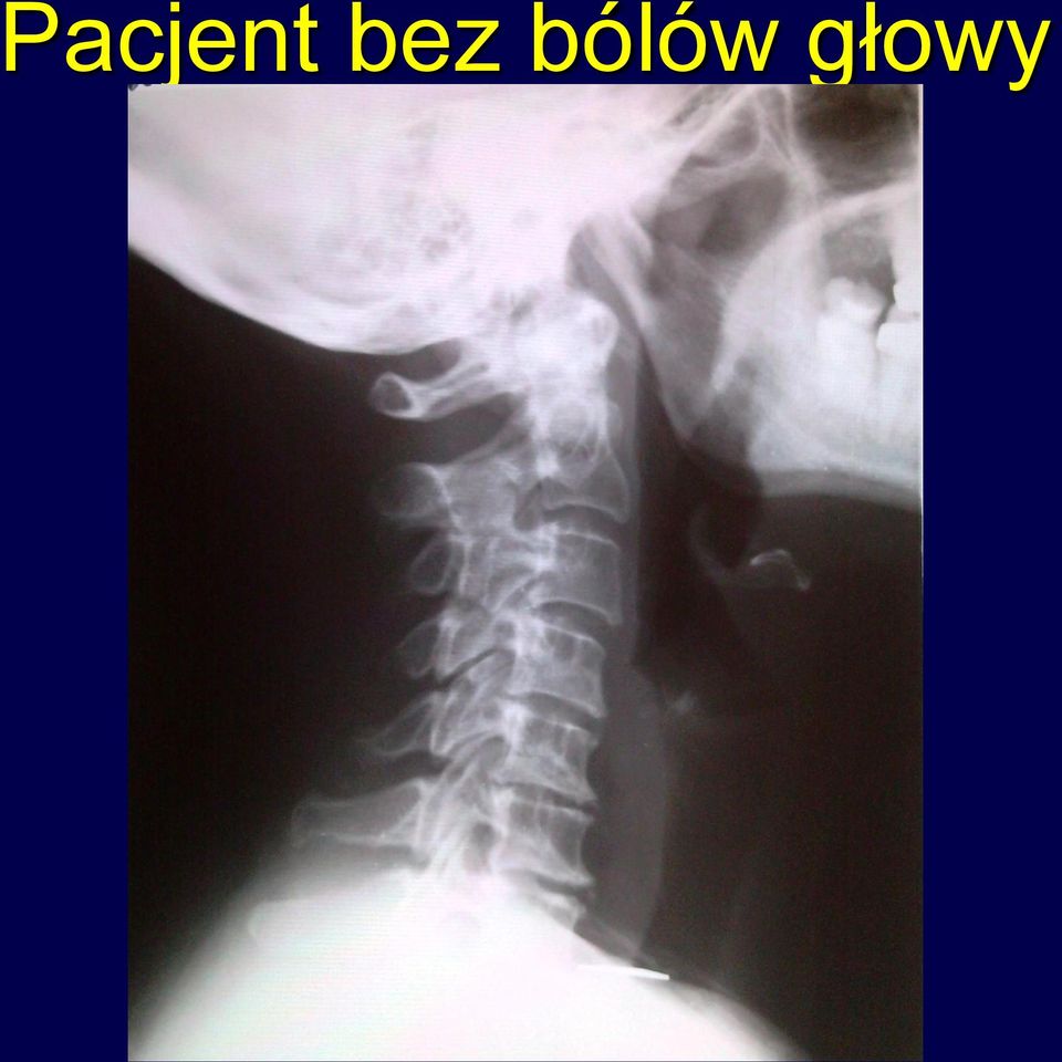 głowy