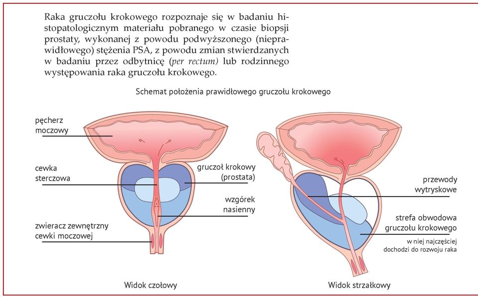 krokowego.