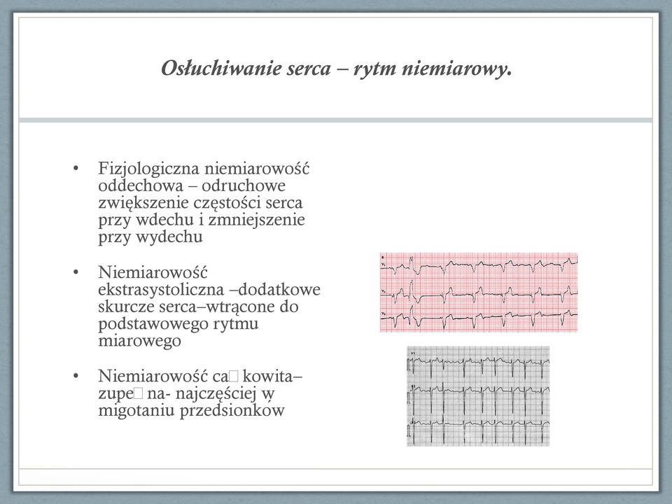 przy wdechu i zmniejszenie przy wydechu Niemiarowość ekstrasystoliczna