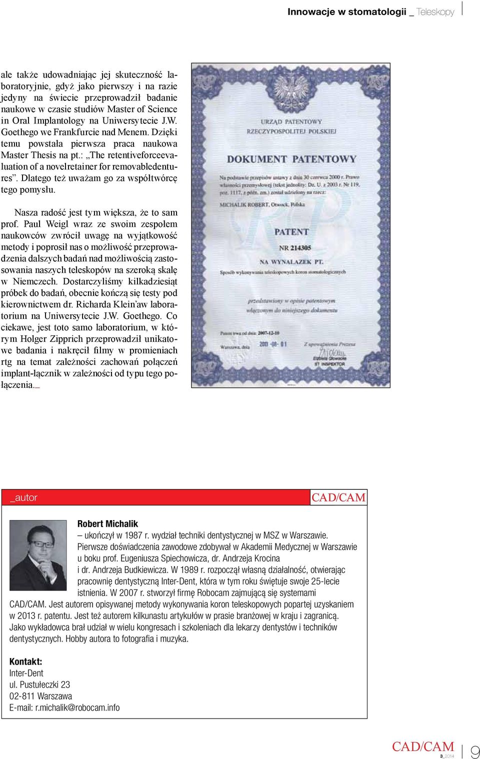 : The retentiveforceevaluation of a novelretainer for removabledentures. Dlatego też uważam go za współtwórcę tego pomysłu. Nasza radość jest tym większa, że to sam prof.