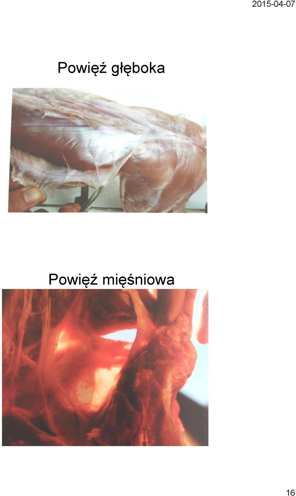 mięśniowa
