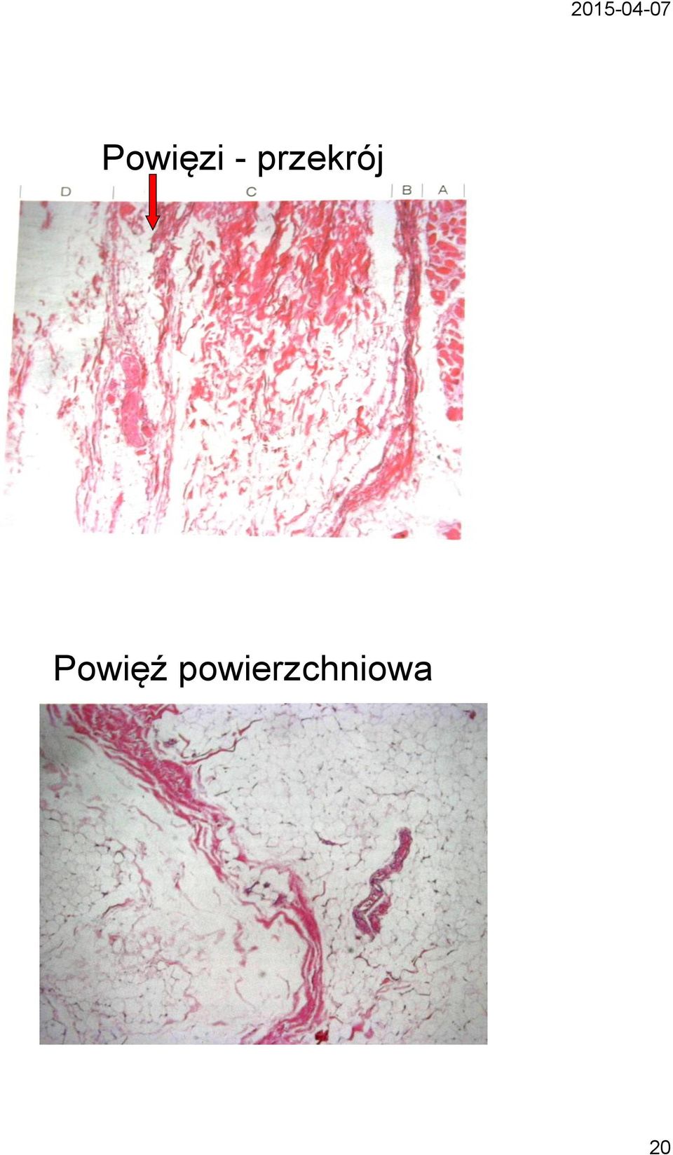 Powięź
