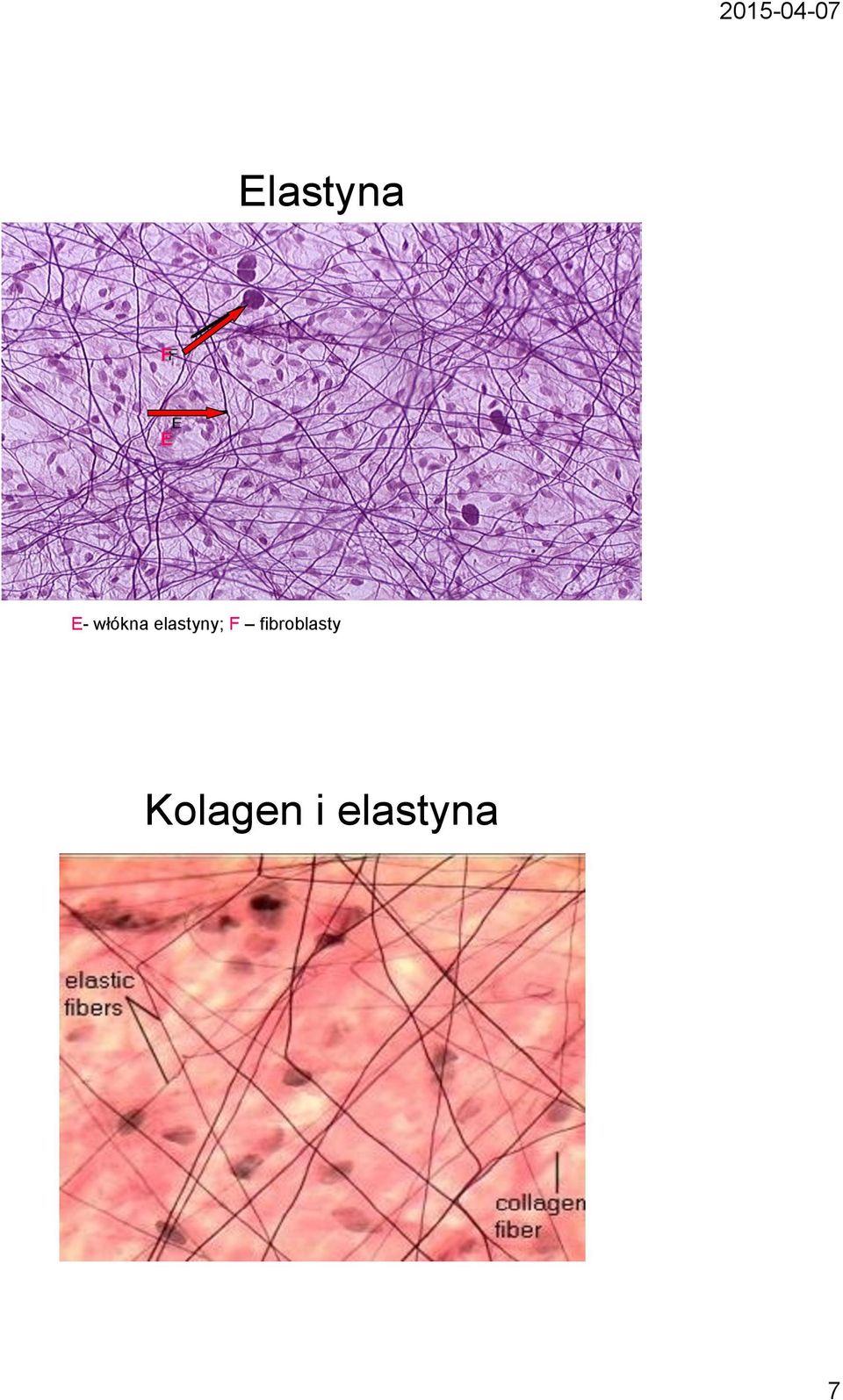 F fibroblasty