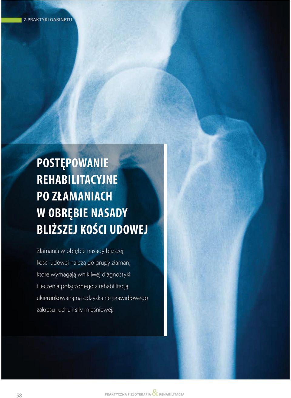 Postepowanie Rehabilitacja Po Zlamaniach W Obrebie Nasady Blizszej Kosci Udowej Pdf Free Download