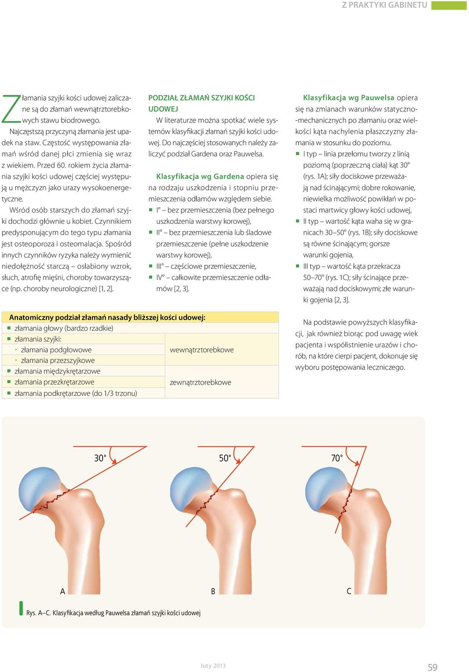 Wśród osób starszych do złamań szyjki dochodzi głównie u kobiet. Czynnikiem predysponującym do tego typu złamania jest osteoporoza i osteomalacja.