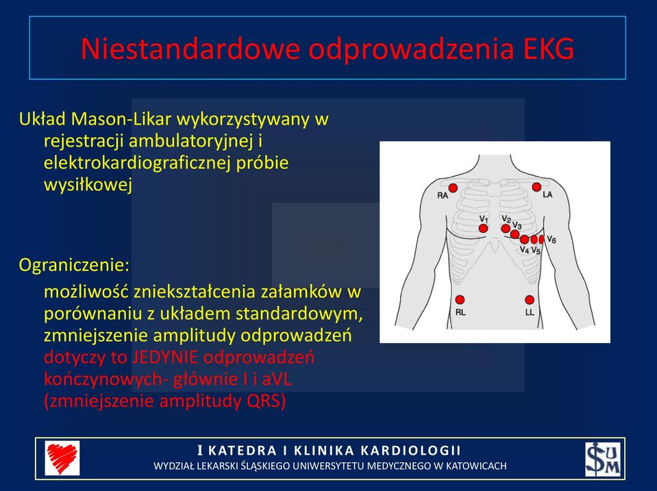 zniekształcenia załamków w porównaniu z układem standardowym, zmniejszenie amplitudy