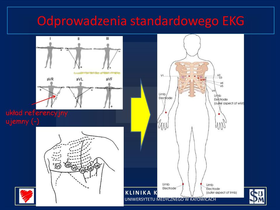 EKG układ