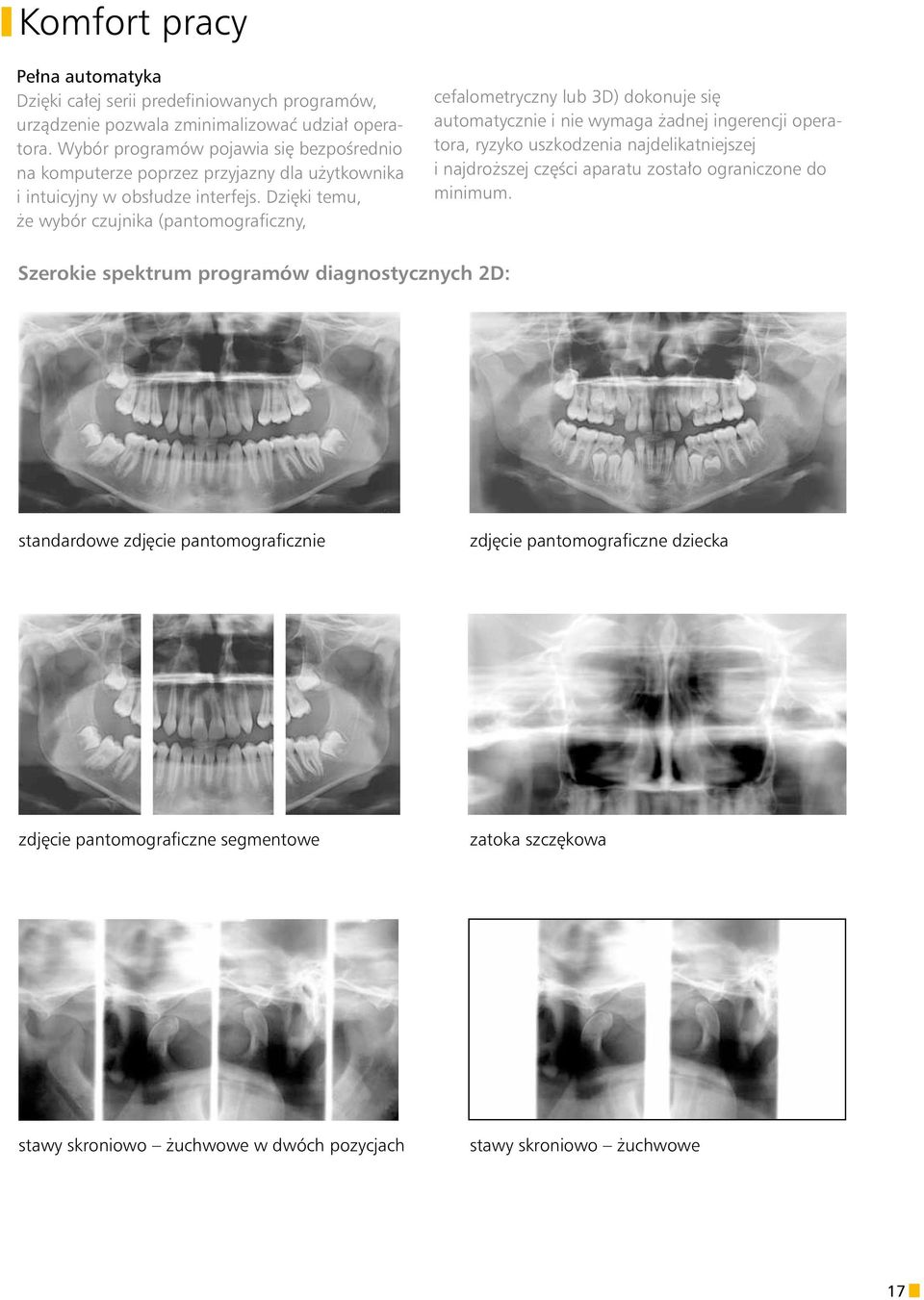 Dzięki temu, że wybór czujnika (pantomograficzny, cefalometryczny lub 3D) dokonuje się automatycznie i nie wymaga żadnej ingerencji operatora, ryzyko uszkodzenia najdelikatniejszej i