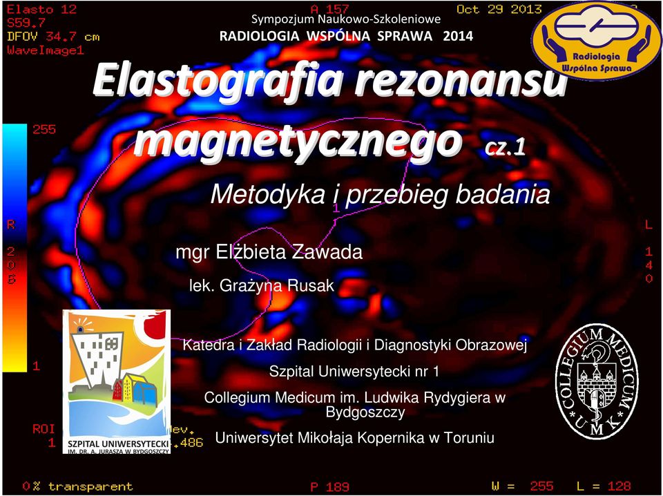 Grażyna Rusak Katedra i Zakład Radiologii i Diagnostyki Obrazowej Szpital