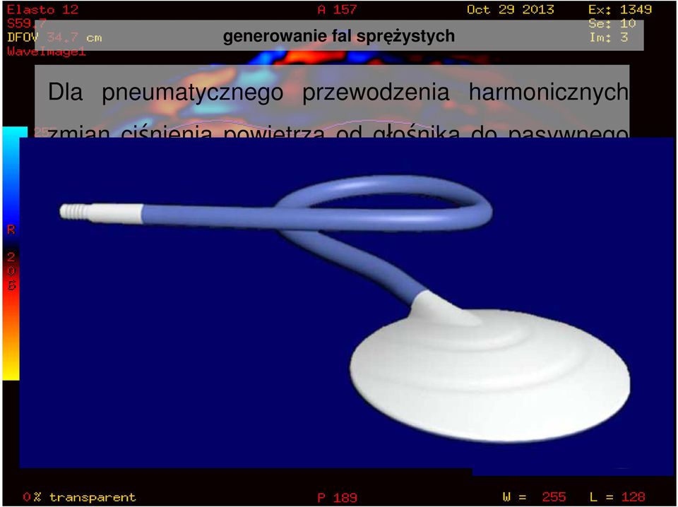 tkanką (sterownik aktywowany ciśnieniem) stosuje się rury (tuby) łączące.