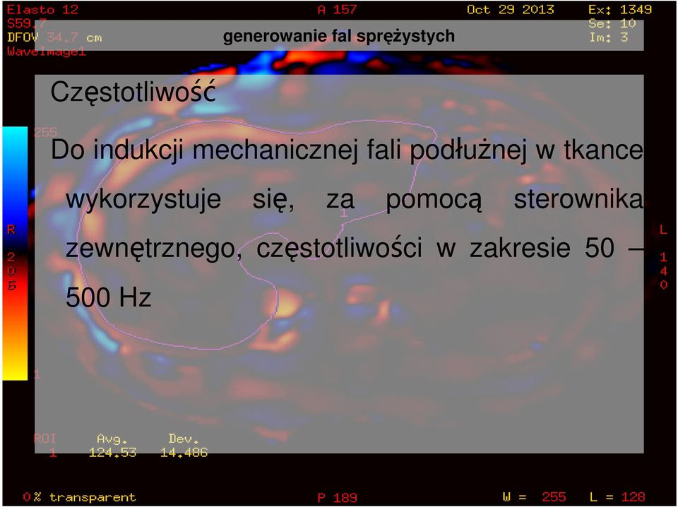 tkance wykorzystuje się, za pomocą