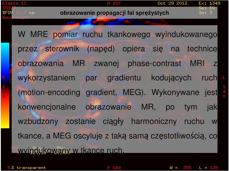 ruch (motion-encoding gradient, MEG).
