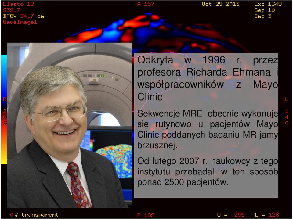Sekwencje MRE obecnie wykonuje się rutynowo u pacjentów Mayo Clinic