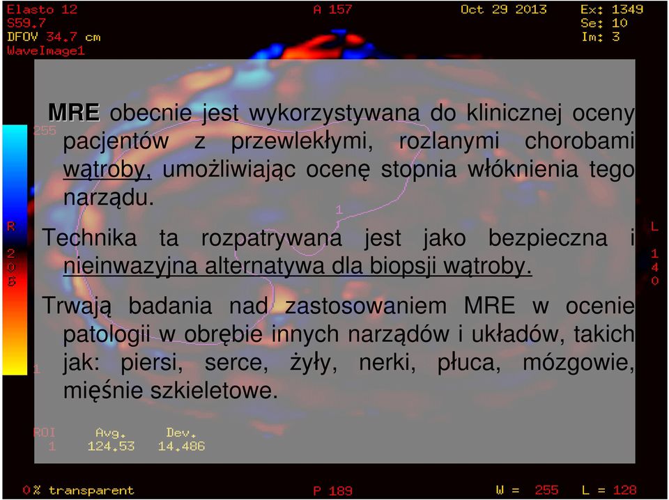 Technika ta rozpatrywana jest jako bezpieczna i nieinwazyjna alternatywa dla biopsji wątroby.