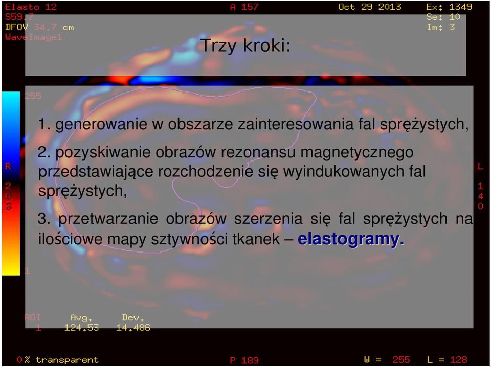 pozyskiwanie obrazów rezonansu magnetycznego przedstawiające
