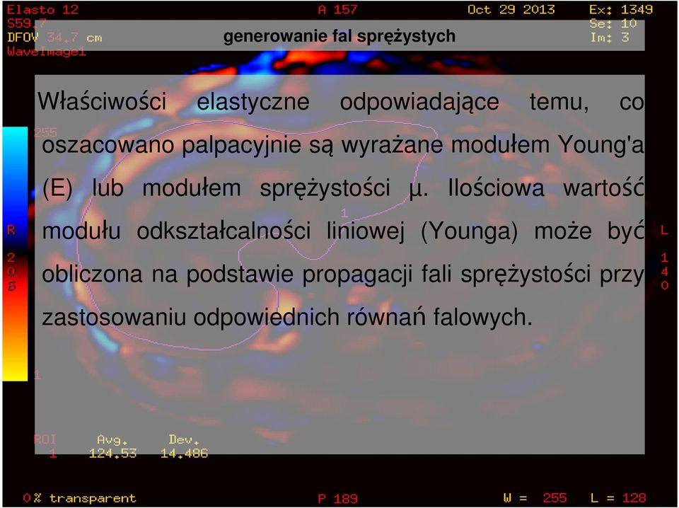 Ilościowa wartość modułu odkształcalności liniowej (Younga) może być obliczona na