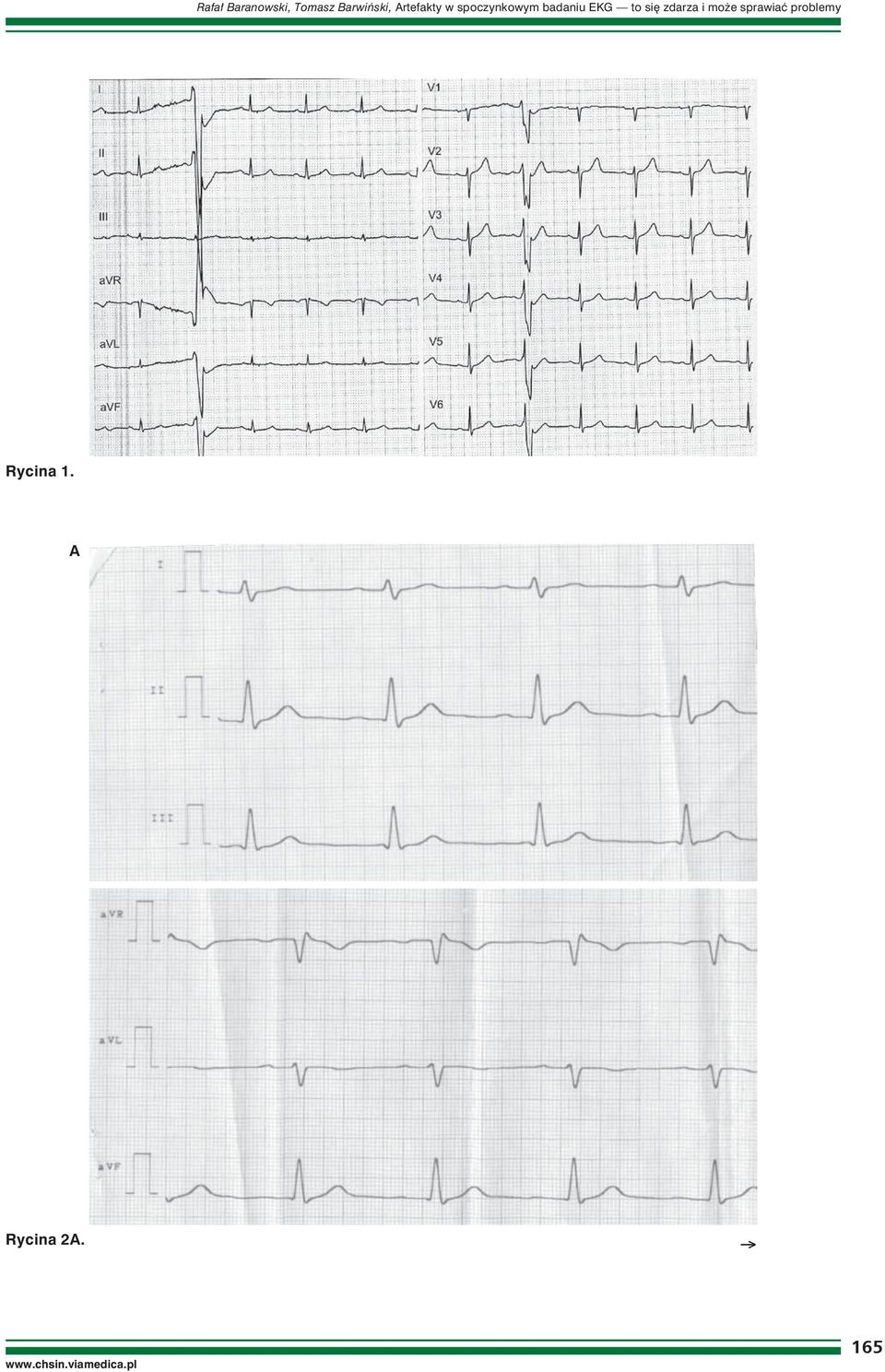 EKG to się zdarza i może sprawiać