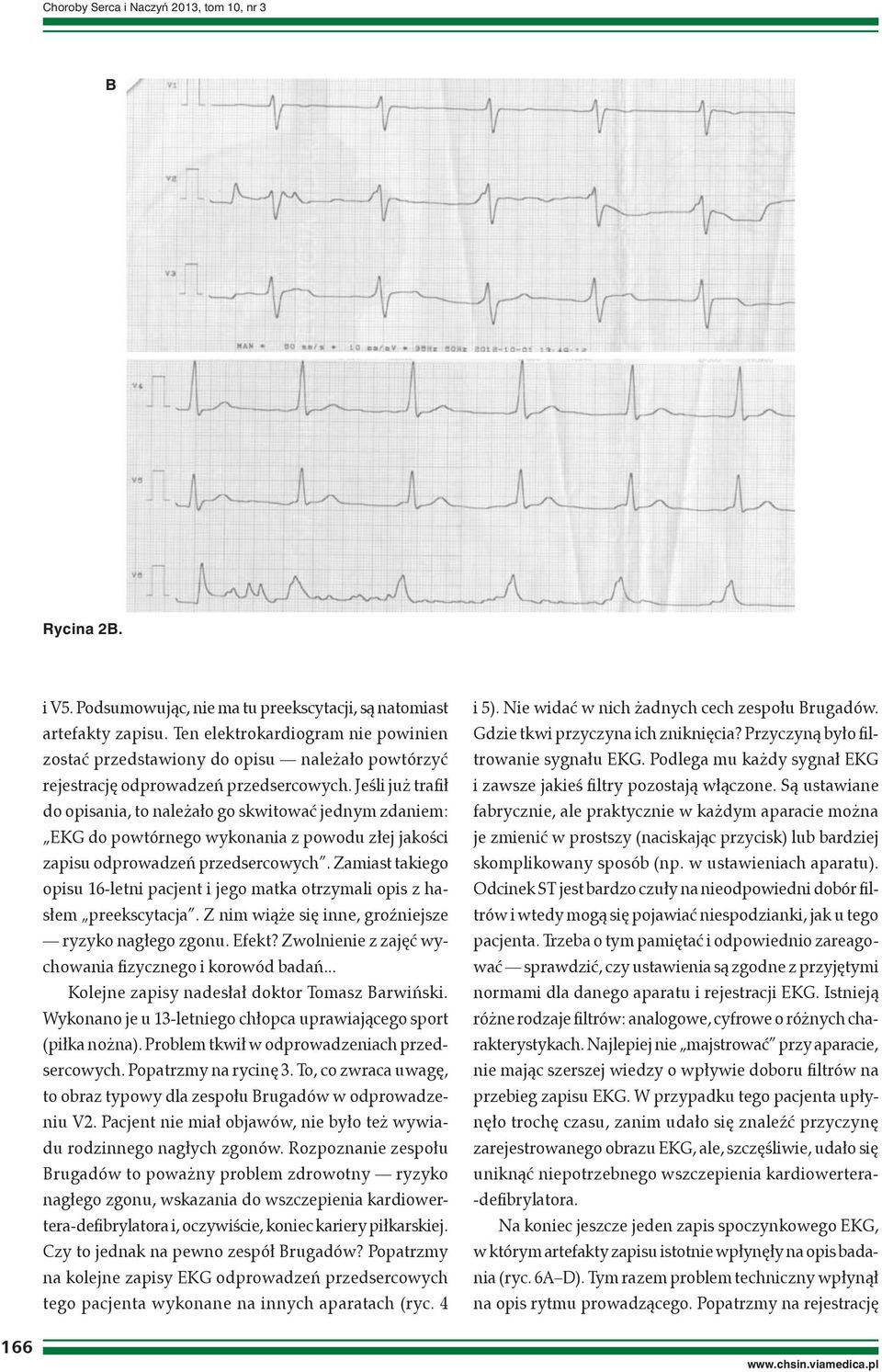 Jeśli już trafił do opisania, to należało go skwitować jednym zdaniem: EKG do powtórnego wykonania z powodu złej jakości zapisu odprowadzeń przedsercowych.