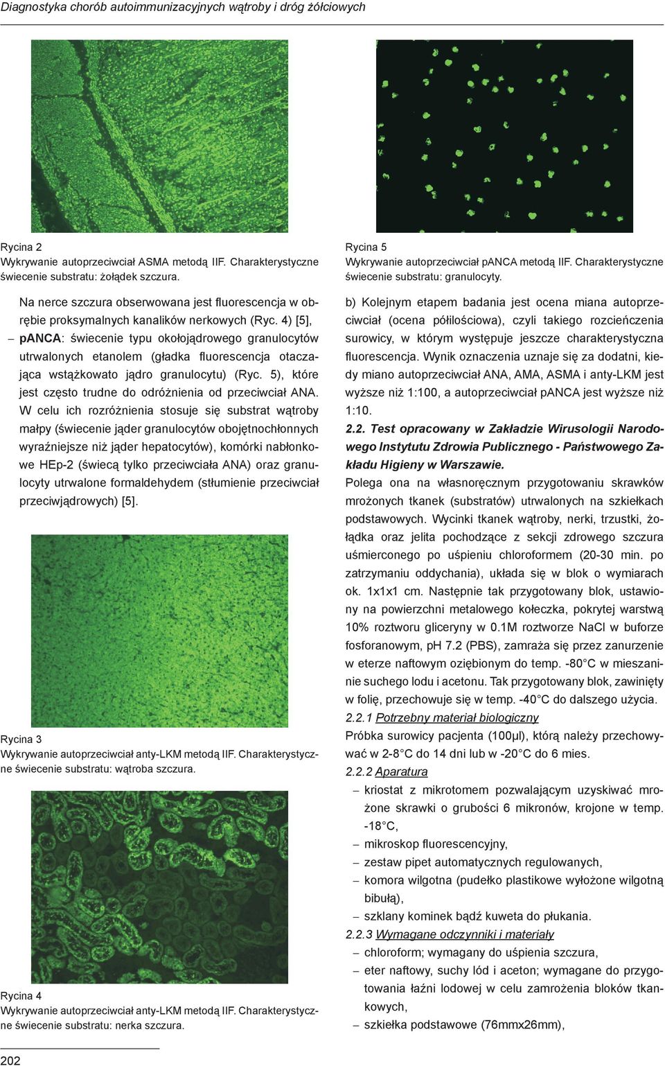 Na nerce szczura obserwowana jest fluorescencja w obrębie proksymalnych kanalików nerkowych (Ryc.