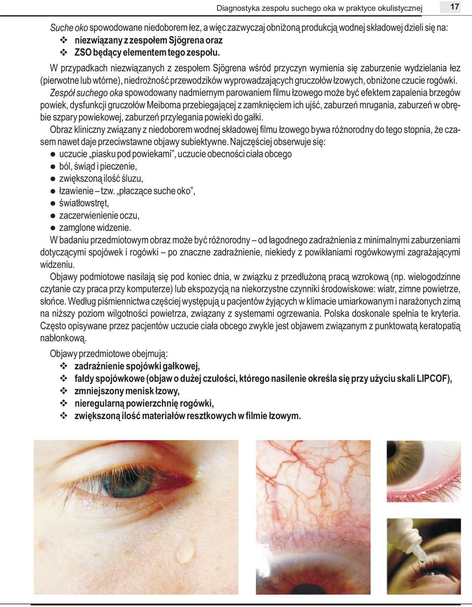 W przypadkach niezwiązanych z zespołem Sjögrena wśród przyczyn wymienia się zaburzenie wydzielania łez (pierwotne lub wtórne), niedrożność przewodzików wyprowadzających gruczołów łzowych, obniżone