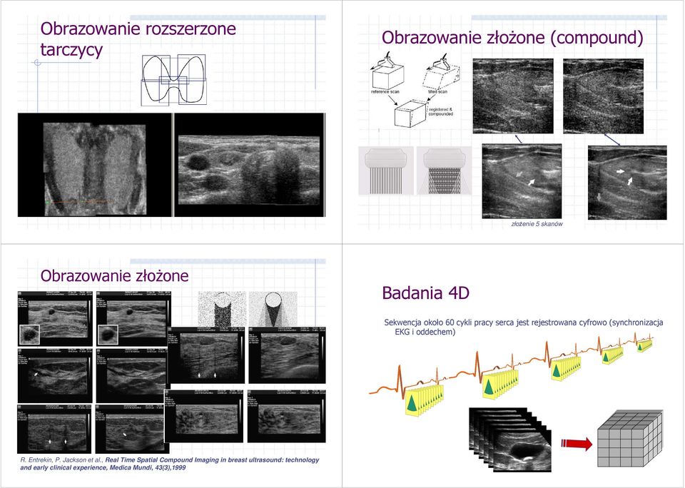 cyfrowo (synchronizacja EKG i oddechem) R. Entrekin, P. Jackson et al.