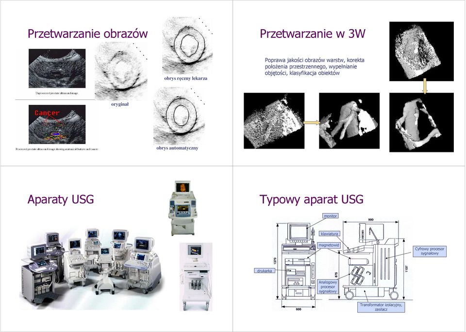 oryginał obrys automatyczny Aparaty USG Typowy aparat USG monitor klawiatura magnetowid