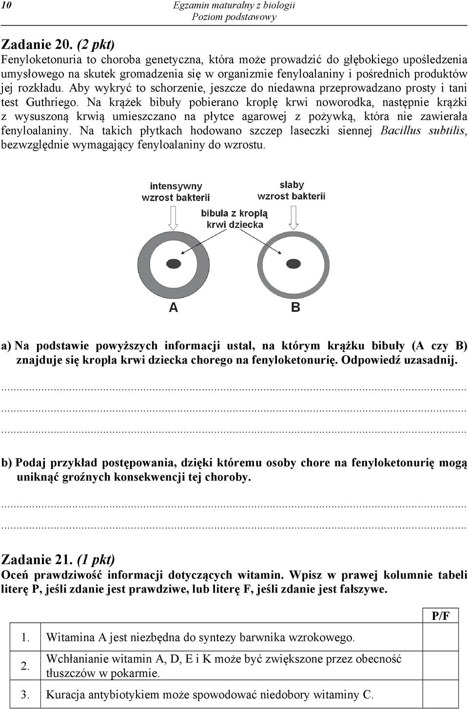 Aby wykryć to schorzenie, jeszcze do niedawna przeprowadzano prosty i tani test Guthriego.