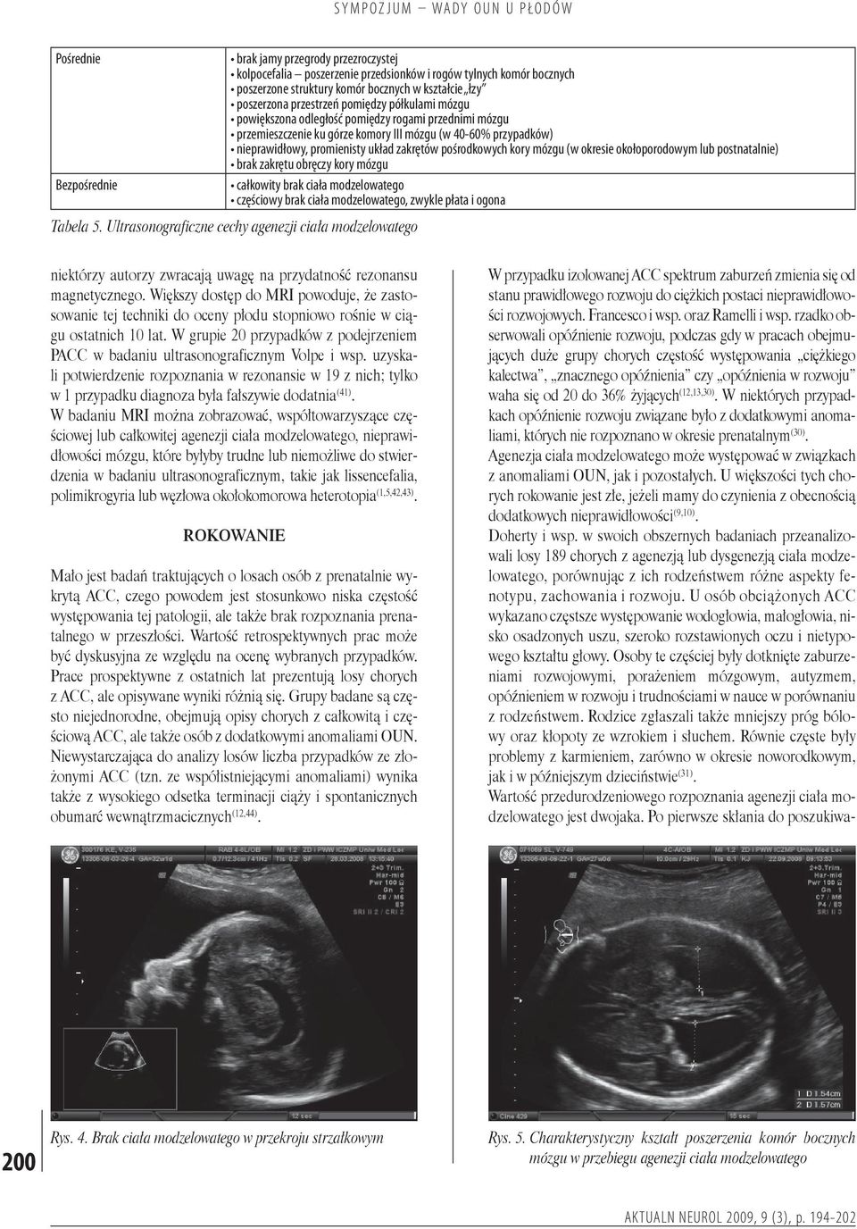 pośrodkowych kory mózgu (w okresie okołoporodowym lub postnatalnie) brak zakrętu obręczy kory mózgu całkowity brak ciała modzelowatego częściowy brak ciała modzelowatego, zwykle płata i ogona Tabela