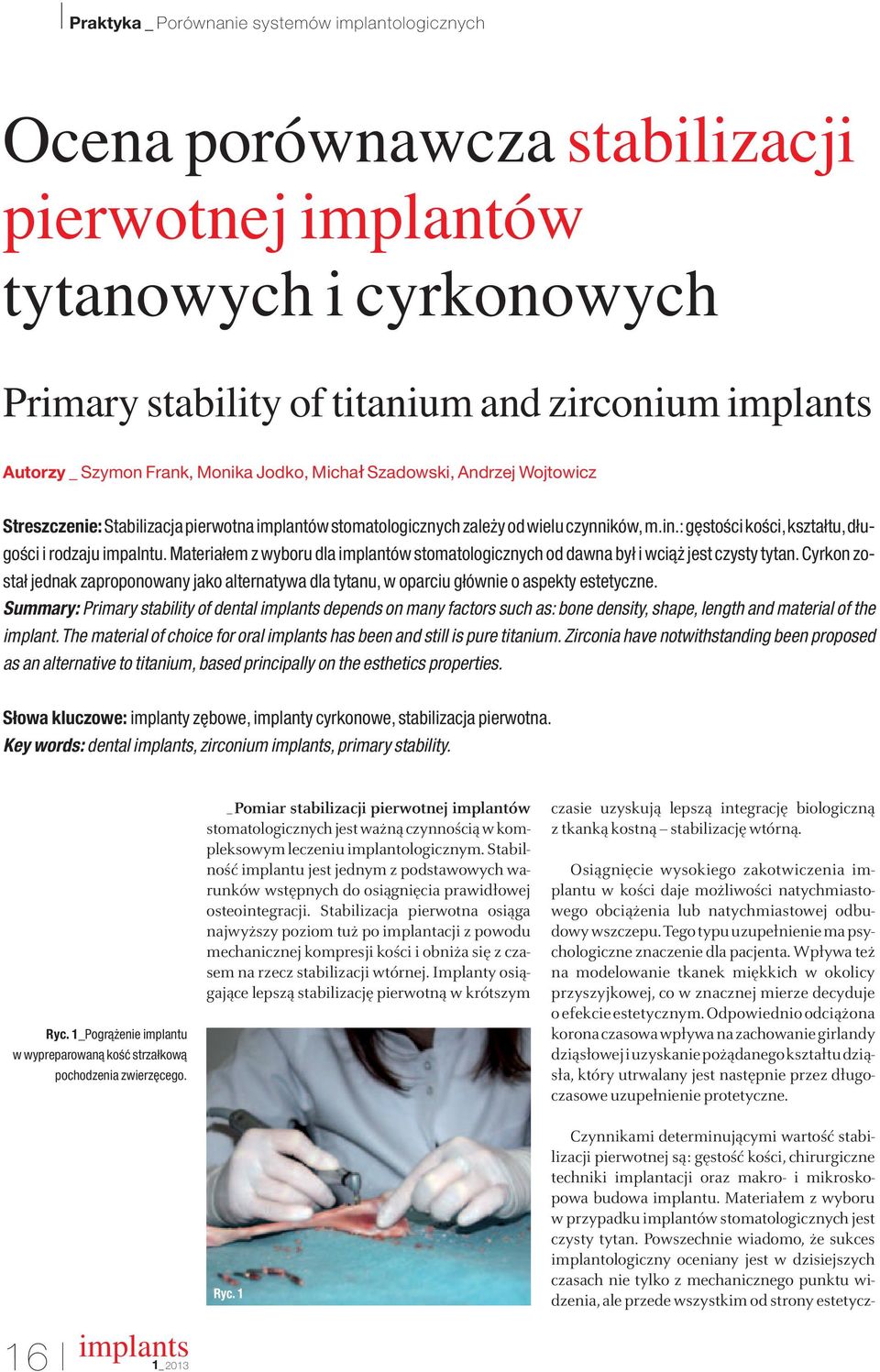 : g stoêci koêci, kształtu, długoêci i rodzaju impalntu. Materiałem z wyboru dla implantów stomatologicznych od dawna był i wcià jest czysty tytan.
