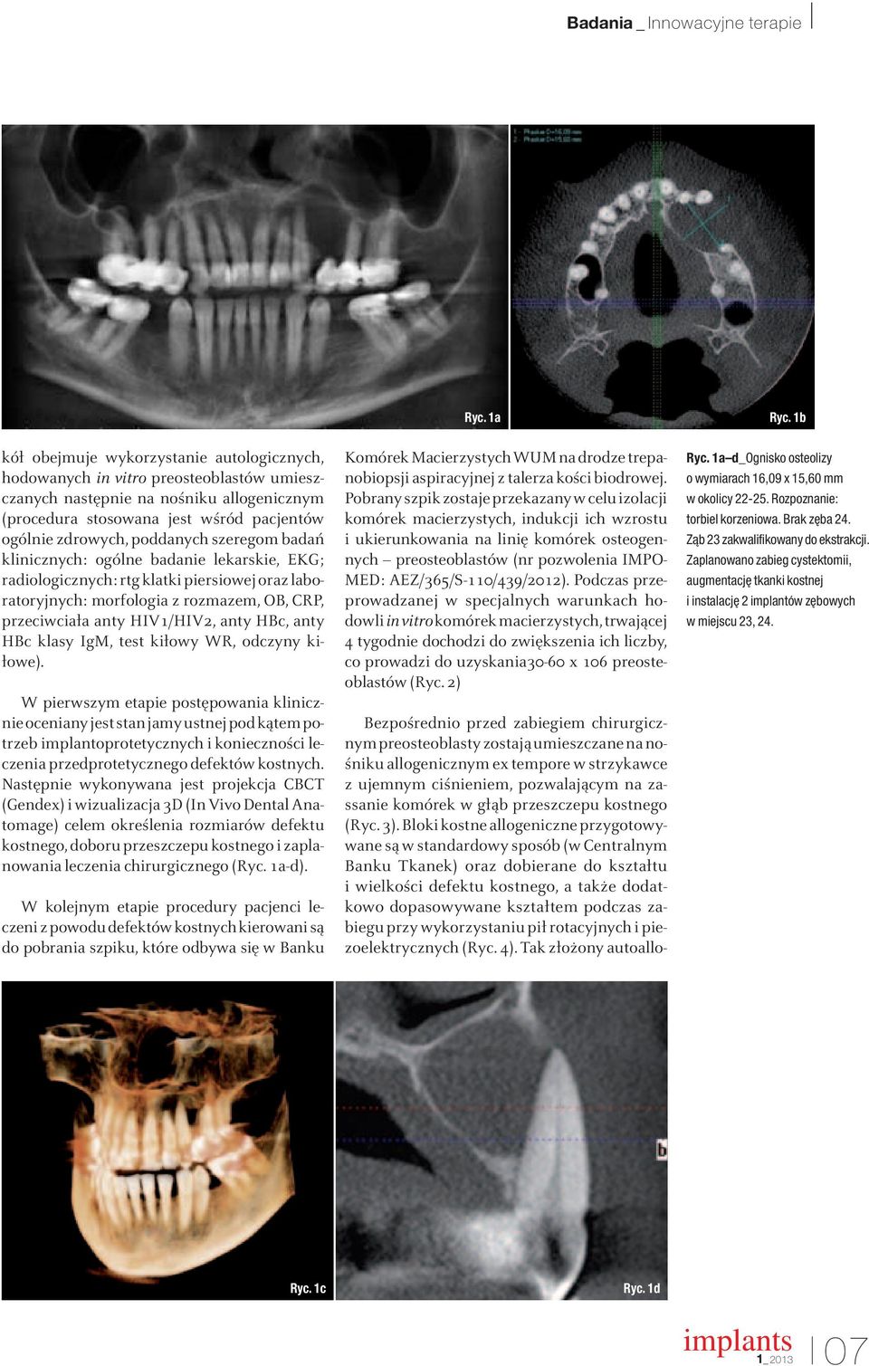 poddanych szeregom badań klinicznych: ogólne badanie lekarskie, EKG; radiologicznych: rtg klatki piersiowej oraz laboratoryjnych: morfologia z rozmazem, OB, CRP, przeciwciała anty HIV1/HIV2, anty