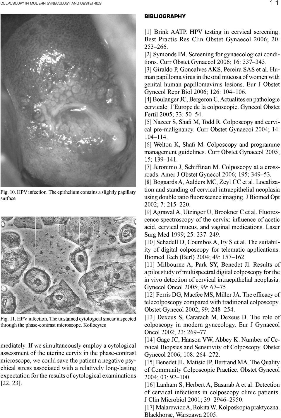 If we simultaneously employ a cytological assessment of the uterine cervix in the phase-contrast microscope, we could save the patient a negative psychical stress associated with a relatively