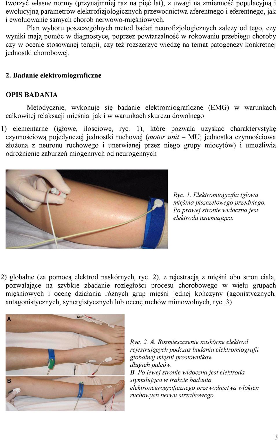 Plan wyboru poszczególnych metod badań neurofizjologicznych zależy od tego, czy wyniki mają pomóc w diagnostyce, poprzez powtarzalność w rokowaniu przebiegu choroby czy w ocenie stosowanej terapii,