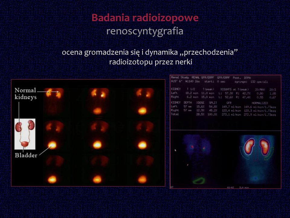 gromadzenia się i dynamika