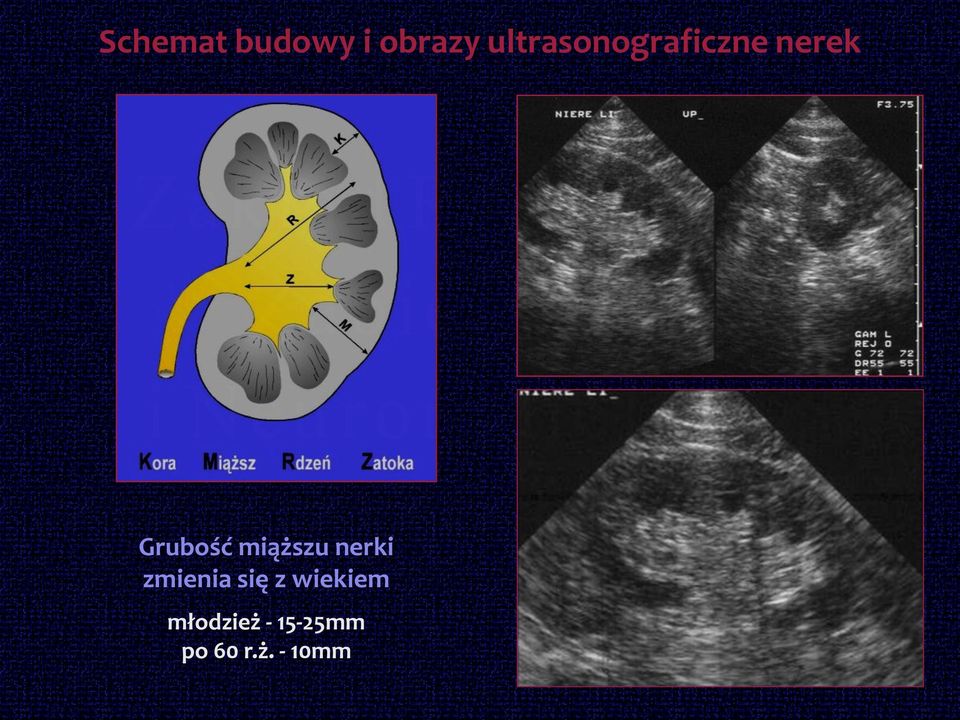miąższu nerki zmienia się z